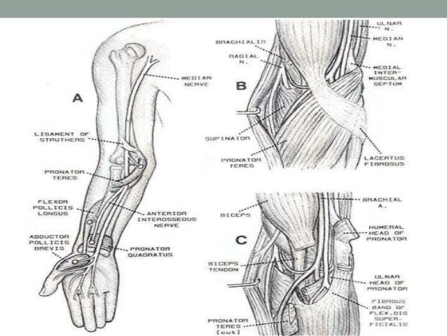 Nerve compression syndromes of the upper limb